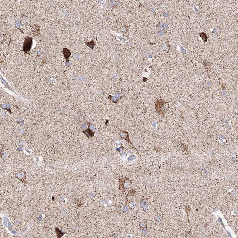 Immunohistochemistry (Formalin/PFA-fixed paraffin-embedded sections) - Anti-Glutaminase antibody (AB260047)