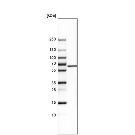 Western blot - Anti-Glutaminase antibody (ab260047), expandable thumbnail