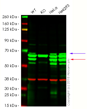 Western blot - Anti-Glutaminase antibody [EP7212] (AB156876), expandable thumbnail