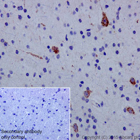 Immunohistochemistry (Formalin/PFA-fixed paraffin-embedded sections) - Anti-Glutaminase antibody [EP7212] - BSA and Azide free (AB214802)