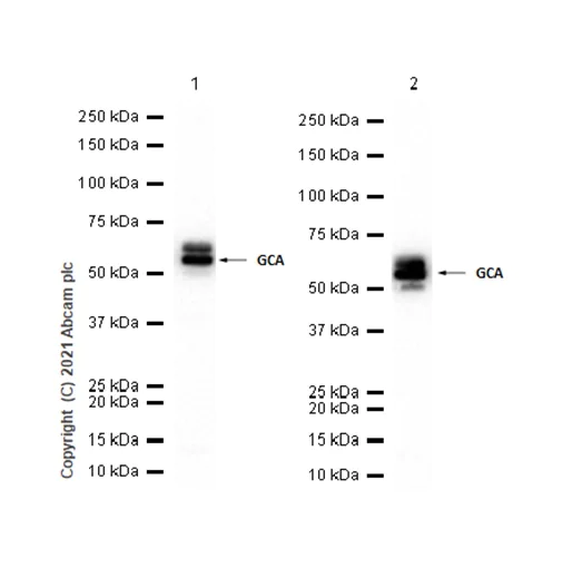 Western blot - Anti-Glutaminase antibody [EP7212] - BSA and Azide free (AB214802)