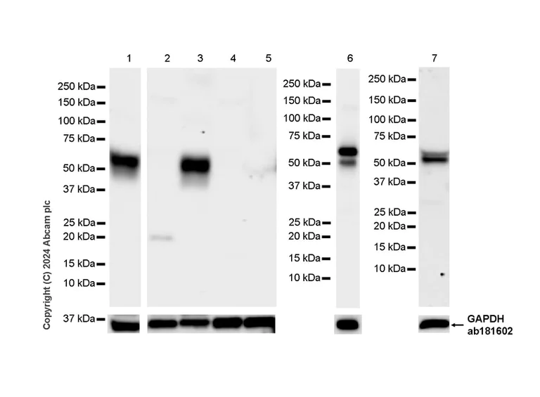 Western blot - Anti-Glutaminase antibody [EPR28716-72] - BSA and Azide free (AB317033)