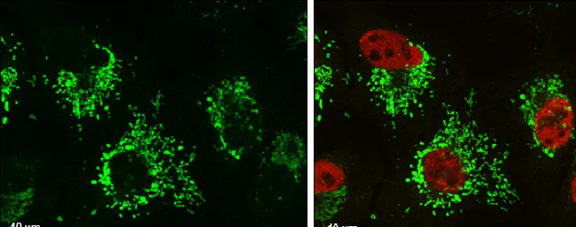 Immunocytochemistry/ Immunofluorescence - Anti-Glutaminase C antibody (AB262716)
