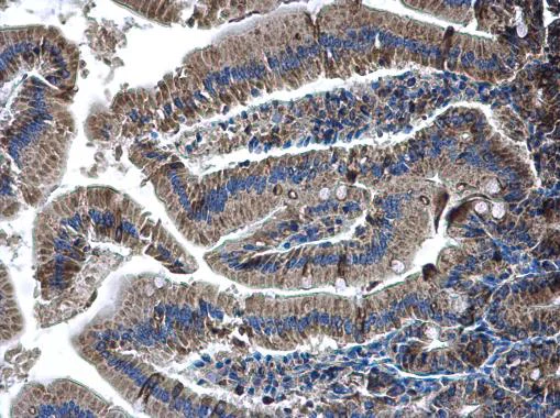 Immunohistochemistry (Formalin/PFA-fixed paraffin-embedded sections) - Anti-Glutaminase C antibody (AB262716)