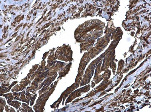 Immunohistochemistry (Formalin/PFA-fixed paraffin-embedded sections) - Anti-Glutaminase C antibody (AB262716)