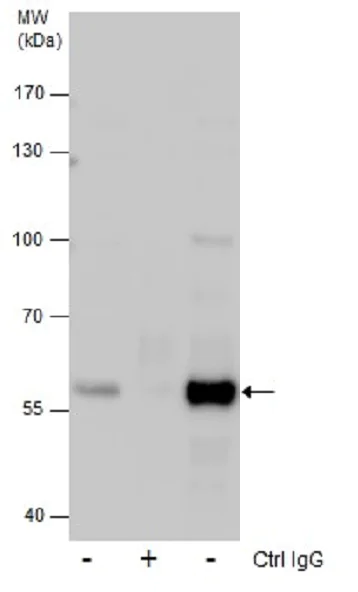 Immunoprecipitation - Anti-Glutaminase C antibody (AB262716)