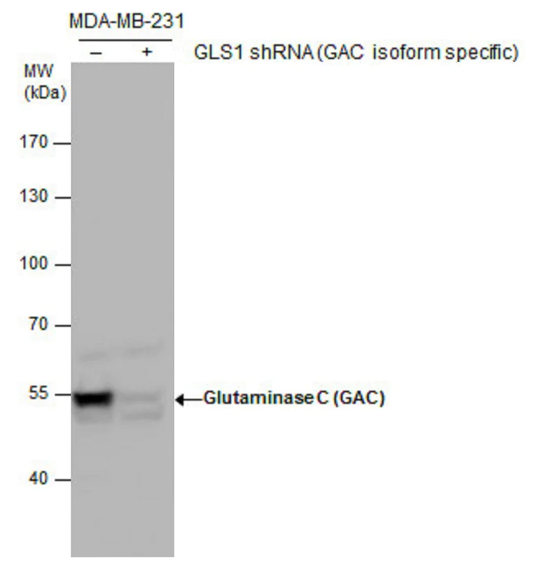 Western blot - Anti-Glutaminase C antibody (AB262716)