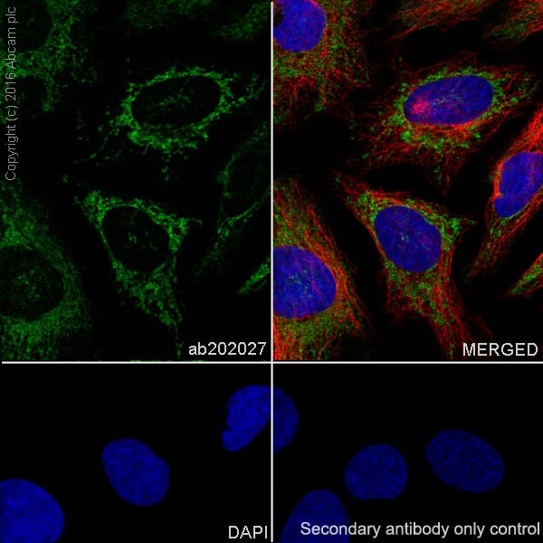 Immunocytochemistry/ Immunofluorescence - Anti-Glutaminase C antibody [EPR19525] (AB202027), expandable thumbnail