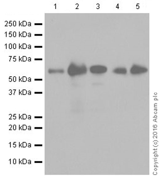Western blot - Anti-Glutaminase C antibody [EPR19525] (ab202027), expandable thumbnail