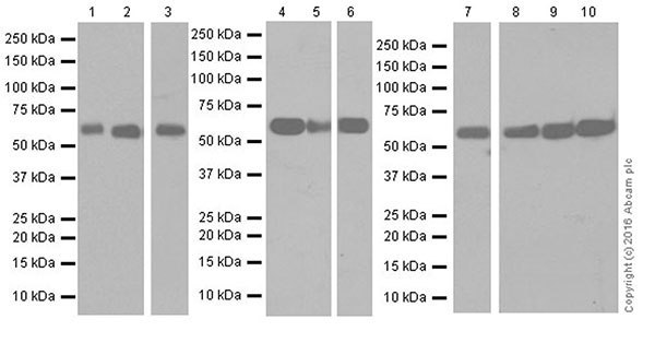 Western blot - Anti-Glutaminase C antibody [EPR19525] (ab202027), expandable thumbnail