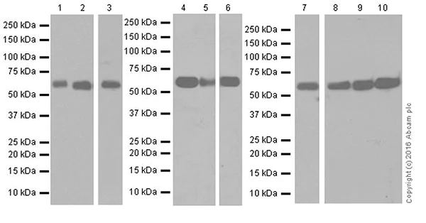 Western blot - Anti-Glutaminase C antibody [EPR19525] (AB202027)