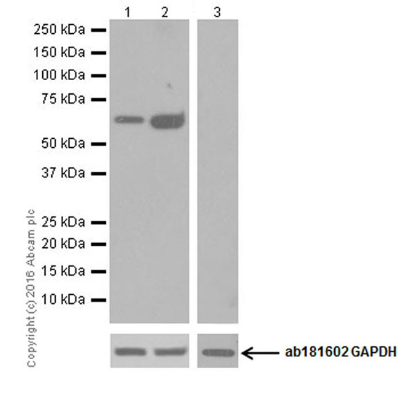 Western blot - Anti-Glutaminase C antibody [EPR19525] (AB202027), expandable thumbnail