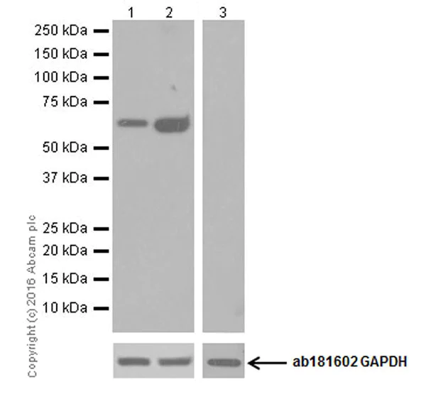 Western blot - Anti-Glutaminase C antibody [EPR19525] (AB202027)