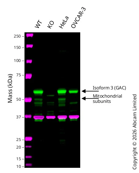 Western blot - Anti-Glutaminase C antibody [EPR19525] (AB202027)