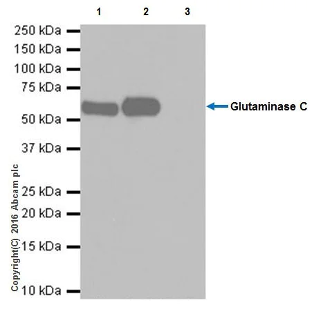 Immunoprecipitation - Anti-Glutaminase C antibody [EPR19525] - BSA and Azide free (AB223129)