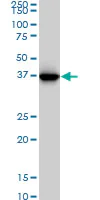 Western blot - Anti-Glutamine Synthetase antibody [3B6] - BSA and Azide free (AB64613)