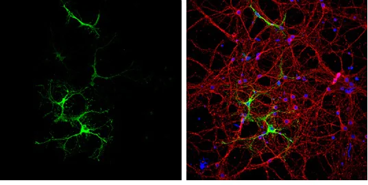 Immunocytochemistry/ Immunofluorescence - Anti-Glutamine Synthetase antibody (AB228590)