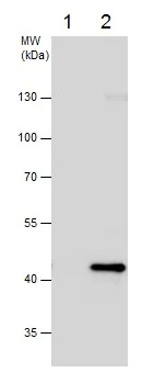 Immunoprecipitation - Anti-Glutamine Synthetase antibody (AB228590)