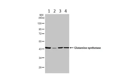Western blot - Anti-Glutamine Synthetase antibody (AB228590)