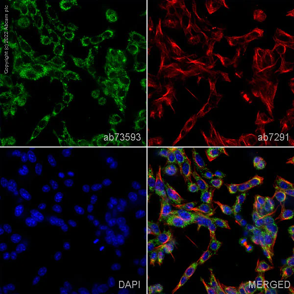 Immunocytochemistry/ Immunofluorescence - Anti-Glutamine Synthetase antibody (AB73593)