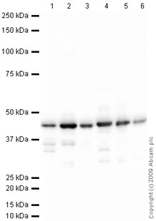 Western blot - Anti-Glutamine Synthetase antibody (AB73593), expandable thumbnail