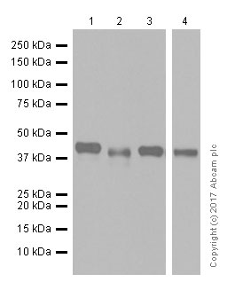 Western blot - Anti-Glutamine Synthetase antibody [EPR13022(B)] (ab176562), expandable thumbnail