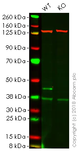 Western blot - Anti-Glutamine Synthetase antibody [EPR13022(B)] (AB176562)