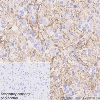 Immunohistochemistry (Formalin/PFA-fixed paraffin-embedded sections) - Anti-Glutamine Synthetase antibody [EPR13022(B)] - BSA and Azide free (ab240193), expandable thumbnail