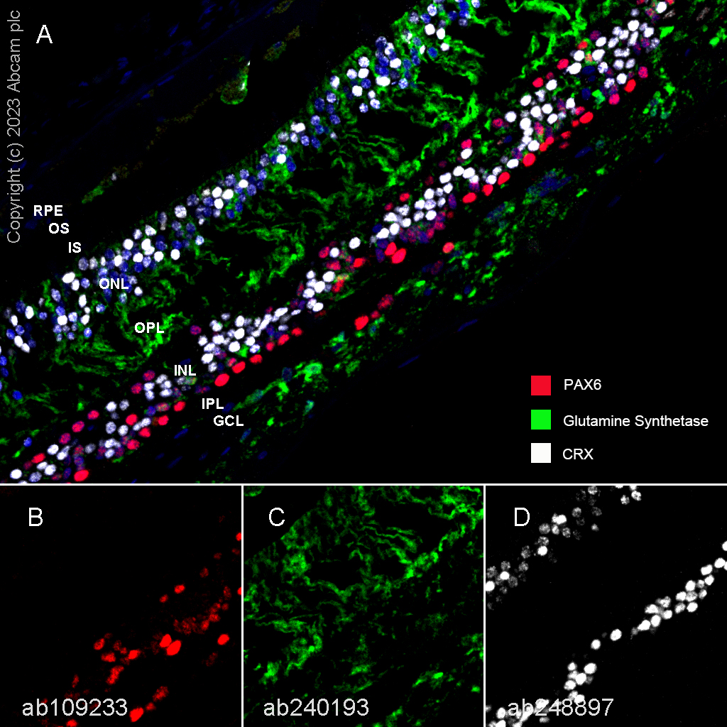 Multiplex immunohistochemistry - Anti-Glutamine Synthetase antibody [EPR13022(B)] - BSA and Azide free (ab240193), expandable thumbnail