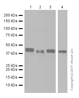 Western blot - Anti-Glutamine Synthetase antibody [EPR13022(B)] - BSA and Azide free (AB240193), expandable thumbnail