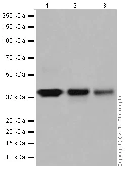 Western blot - Anti-Glutamine Synthetase antibody [EPR16661] (AB197024)