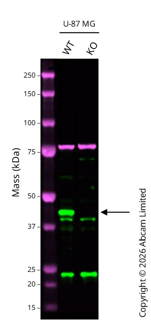 Western blot - Anti-Glutamine Synthetase antibody [EPR16661] (AB197024)