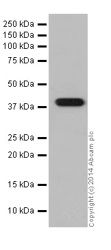 Western blot - Anti-Glutamine Synthetase antibody [EPR16661] (AB197024)