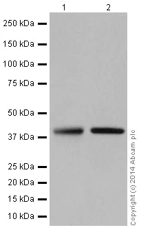 Western blot - Anti-Glutamine Synthetase antibody [EPR16661] (AB197024)