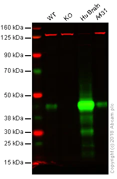 Western blot - Anti-Glutamine Synthetase antibody [EPR16661] (AB197024)