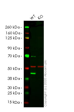 Western blot - Anti-Glutamine Synthetase antibody [EPR16661] - BSA and Azide free (AB251231)