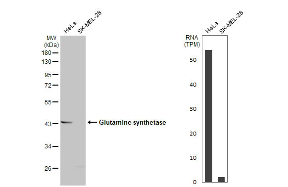 Western blot - Anti-Glutamine synthetase antibody [HL2283] (AB317188)