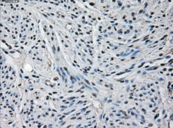Immunohistochemistry (Formalin/PFA-fixed paraffin-embedded sections) - Anti-Glutamine Synthetase antibody [OTI1F4] - BSA and Azide free (AB273647)