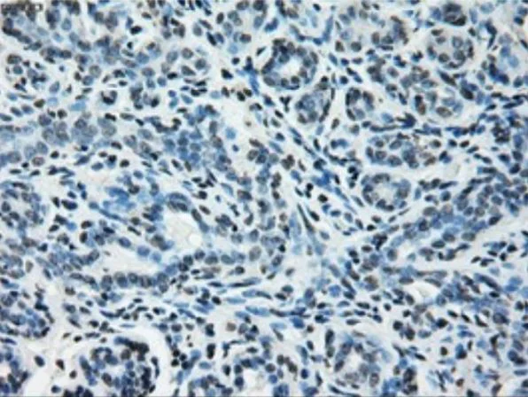 Immunohistochemistry (Formalin/PFA-fixed paraffin-embedded sections) - Anti-Glutamine Synthetase antibody [OTI1F4] - BSA and Azide free (AB273647)