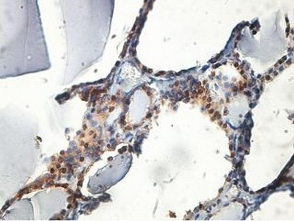 Immunohistochemistry (Formalin/PFA-fixed paraffin-embedded sections) - Anti-Glutaminyl cyclase antibody (AB201172)