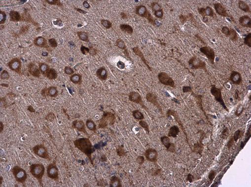 Immunohistochemistry (Formalin/PFA-fixed paraffin-embedded sections) - Anti-Glutamyl Prolyl tRNA synthetase/PARS antibody - C-terminal (AB229498)