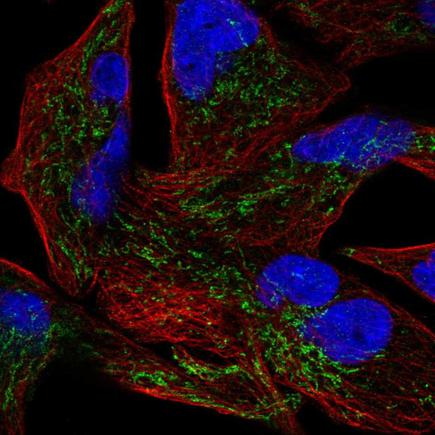 Immunocytochemistry/ Immunofluorescence - Anti-Glutaredoxin 5 antibody (AB221121), expandable thumbnail