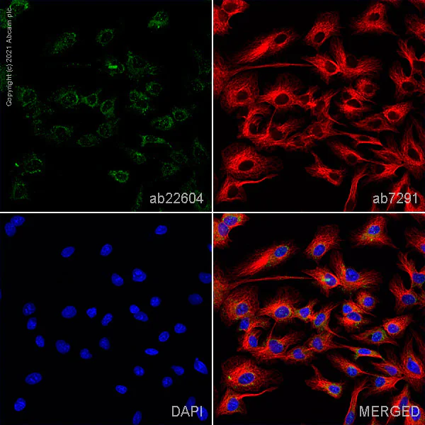 【美品】ALBIT GFD-1 3.15 Ct | Radiant | E Color Lab Grown Diamond | VS1 Clarity | SKU
