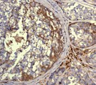 Immunohistochemistry (Formalin/PFA-fixed paraffin-embedded sections) - Anti-Glutathione Peroxidase 1 antibody [EPR3311] - BSA and Azide free (AB247669)