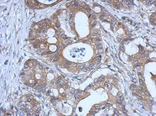 Immunohistochemistry (Formalin/PFA-fixed paraffin-embedded sections) - Anti-Glutathione Peroxidase 2/GPX2 antibody (AB137431)