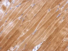 Immunohistochemistry (Formalin/PFA-fixed paraffin-embedded sections) - Anti-Glutathione Peroxidase 2/GPX2 antibody (AB137431)