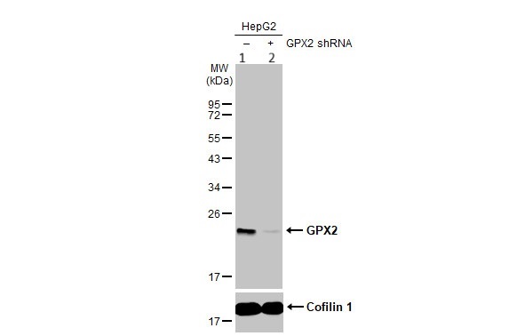 Anti-Glutathione Peroxidase 2/GPX2 antibody (ab137431)