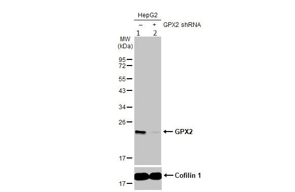 Western blot - Anti-Glutathione Peroxidase 2/GPX2 antibody (AB137431)