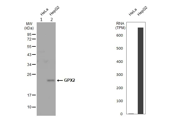 Western blot - Anti-Glutathione Peroxidase 2/GPX2 antibody (AB137431)