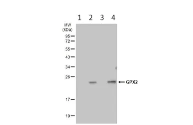 Western blot - Anti-Glutathione Peroxidase 2/GPX2 antibody (AB137431)